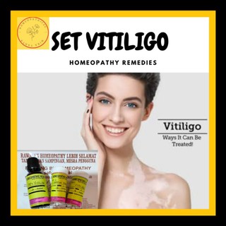 SET VITILIGO HOMEOPATHY  Shopee Malaysia