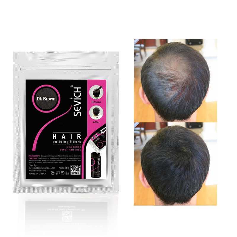 SEVICH Hair Building Fiber Refill Hair Loss Treatment Care (100 g) | Shopee  Malaysia