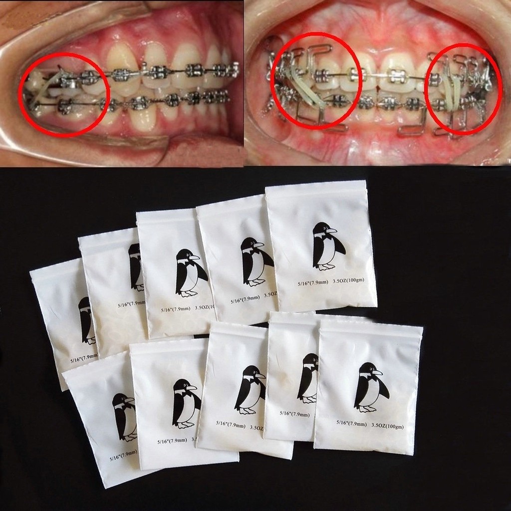 orthodontic rubber bands