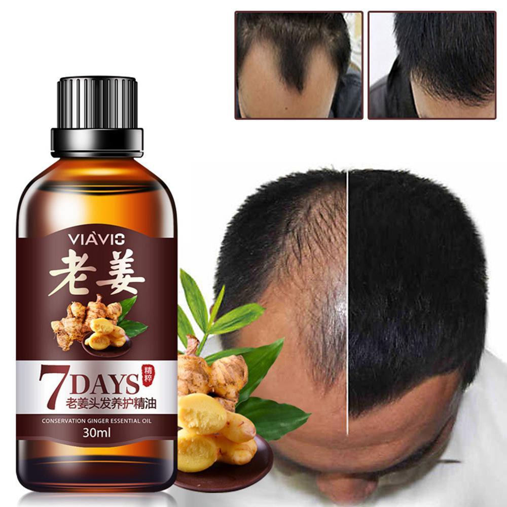 Eenten Ginger Juice Hair Growth Serum Hair Loss Regrowth