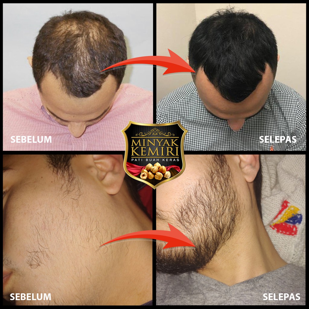 Minyak Kemiri 100 Pati Minyak Buah Keras Asli Untuk Rambut Jambang Misai Shopee Malaysia