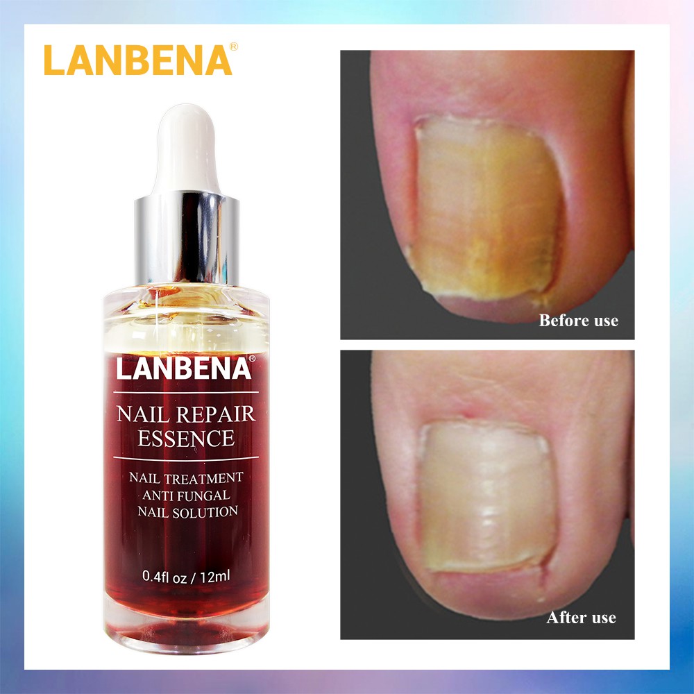 LANBENA Official Store, Online Shop | Shopee Malaysia
