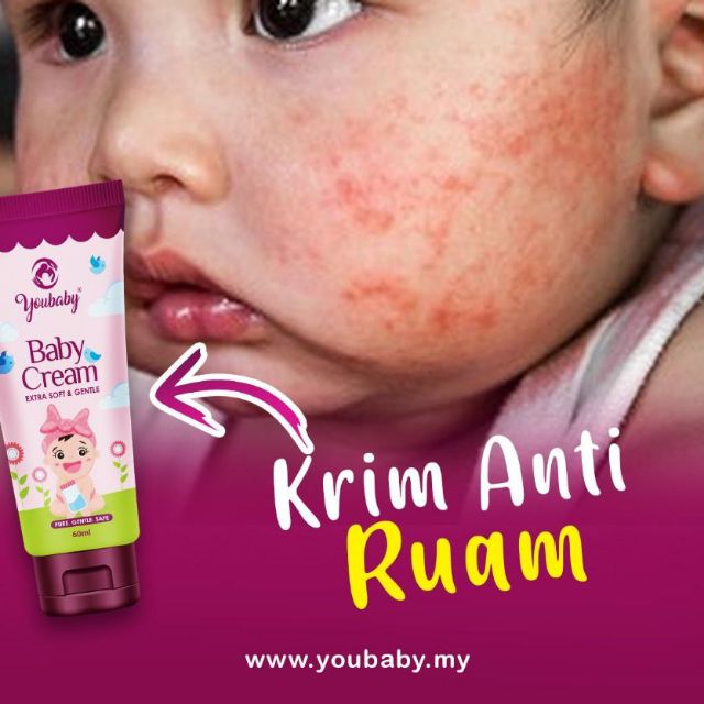 Krim Ruam Dan Gatal Kulit Lulus Kkm Organik Dan Natural Produk Shopee Malaysia