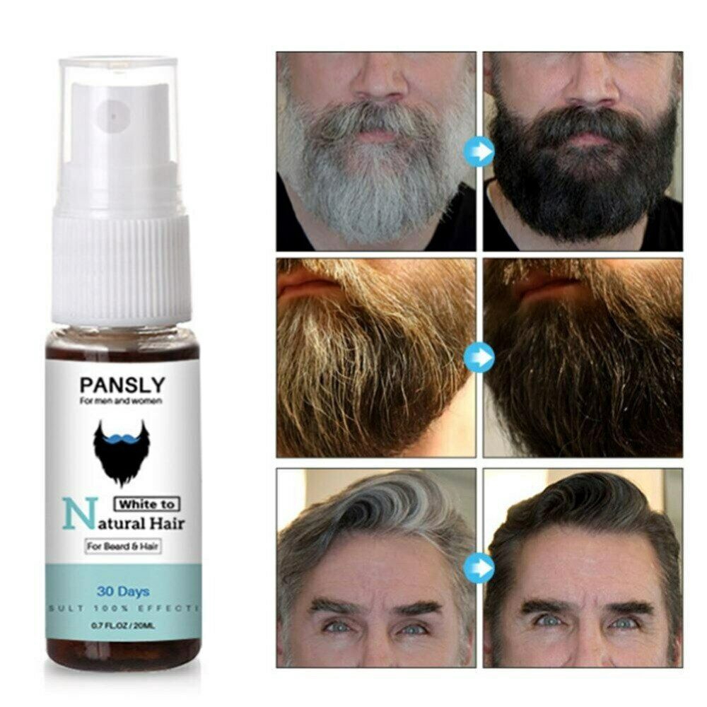 White Gray Beard Hair Treatment Tonic Oil To Natural Black Nutrition In 30  Days | Shopee Malaysia
