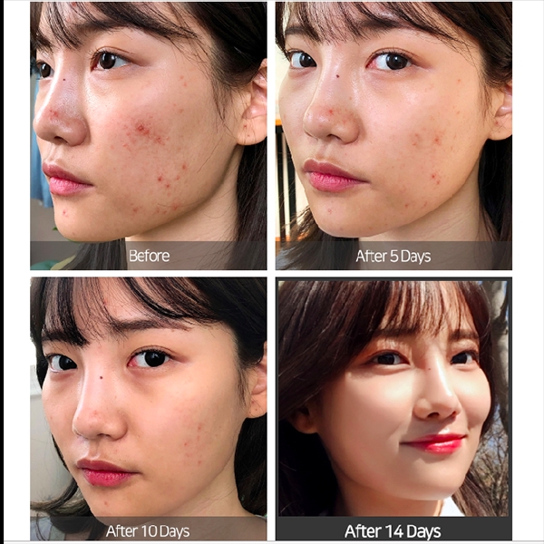 super miracle some by mi