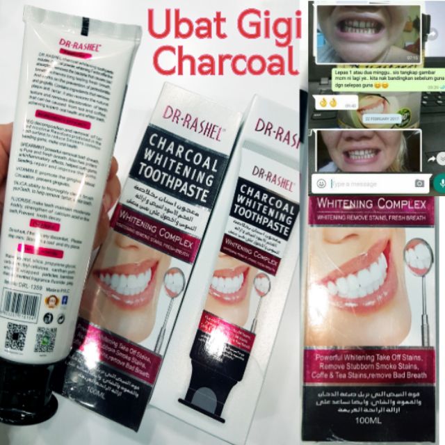 Ubat Gigi Arang Super Pemutih Gigi !!  Shopee Malaysia