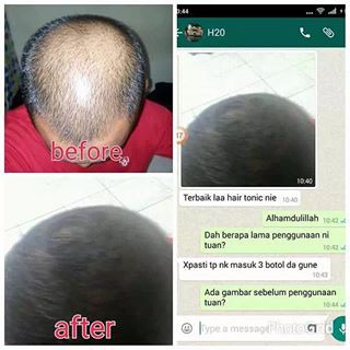 2 BOTOL  TISSA MURAH  Shampoo Rambut  Kepala Botak ORIGINAL 