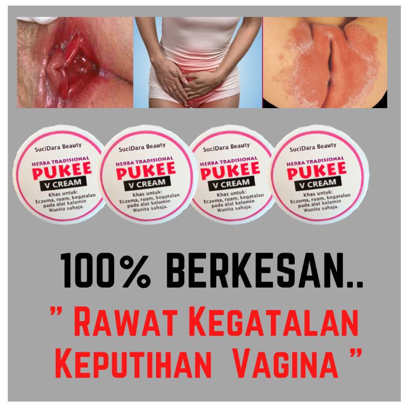 Rawat Gatal Celah Peha Akibat Keputihan Krim Keputihan Gatal Kemaluan Hilangkan Gatal Keputihan Seawal 5 Minit Shopee Malaysia