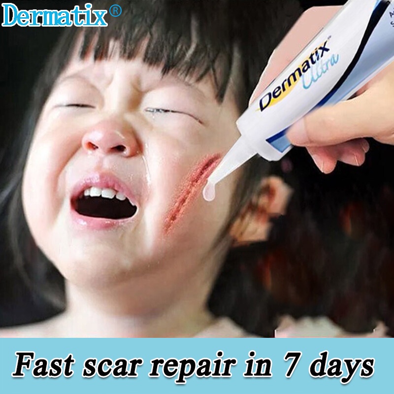 scar remover for old scar on leg DERMATIX repairing surgical scars and
