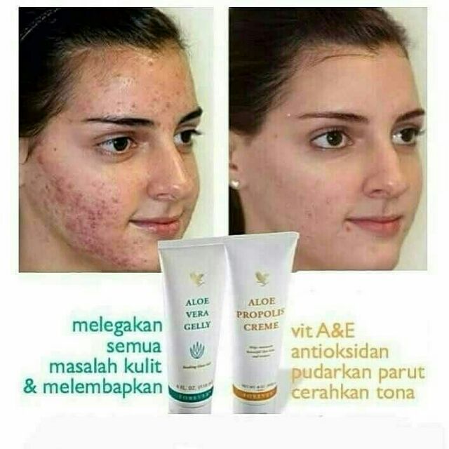 propolis aloe vera cream