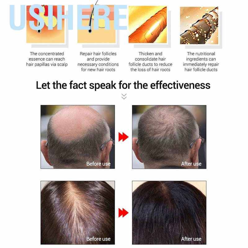 Usihere Lanbena Natural Hair Growth Essence Oil Ginseng Scalp