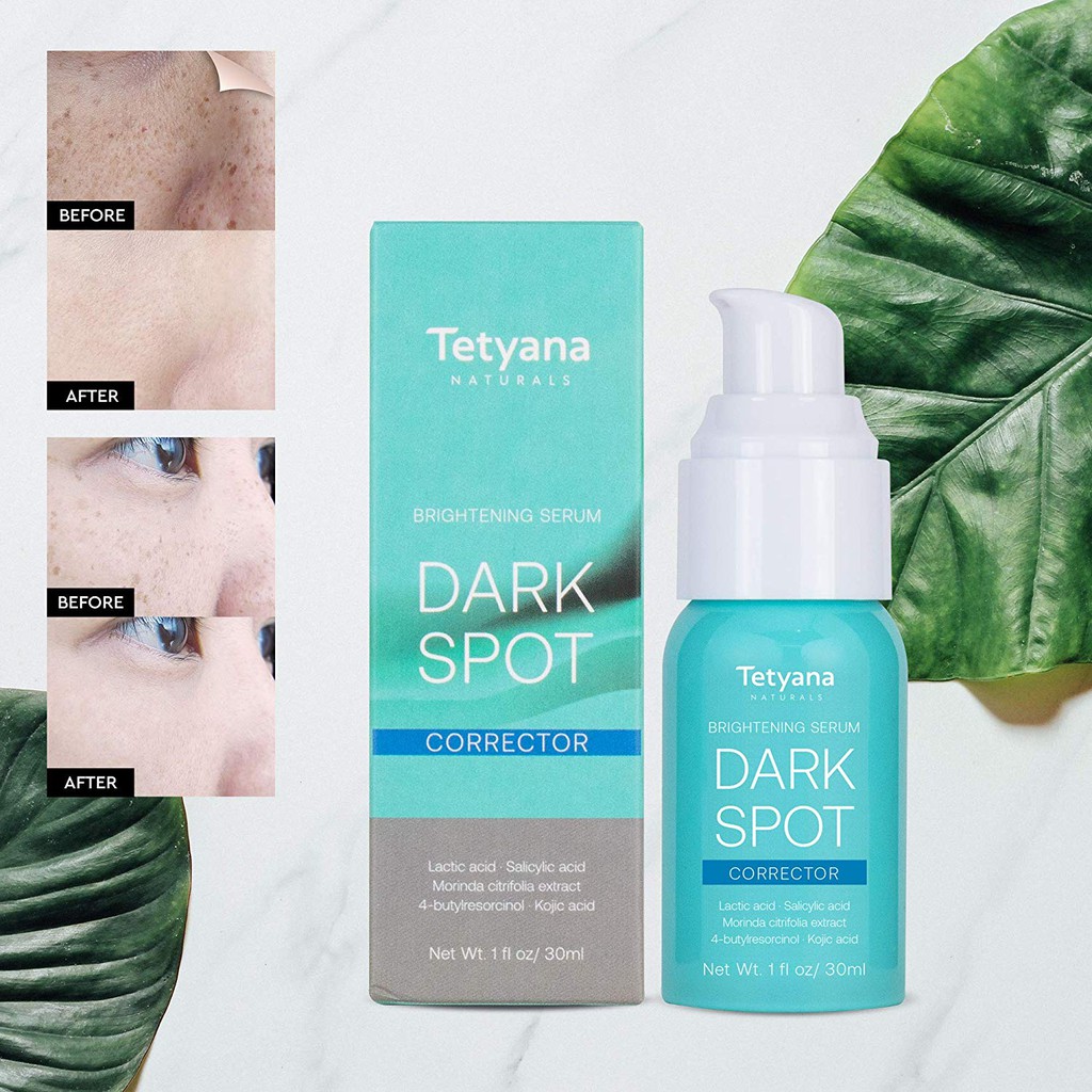 tetyana dark spot cream