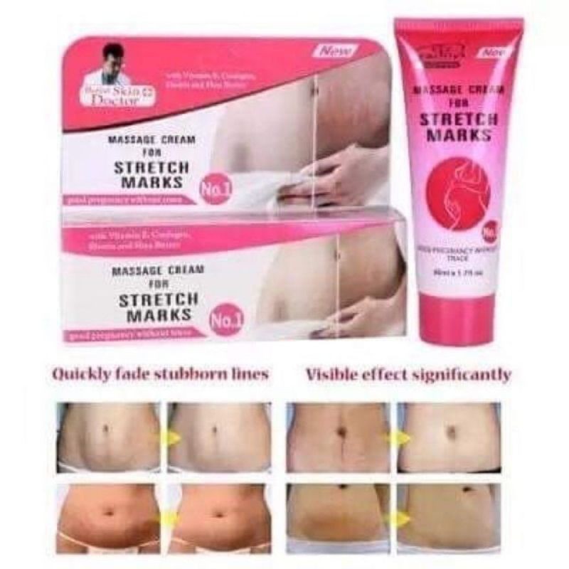 Buy Ready Stock Krim Hilang Stretch Mark Parut消妊娠纹膏 Seetracker Malaysia