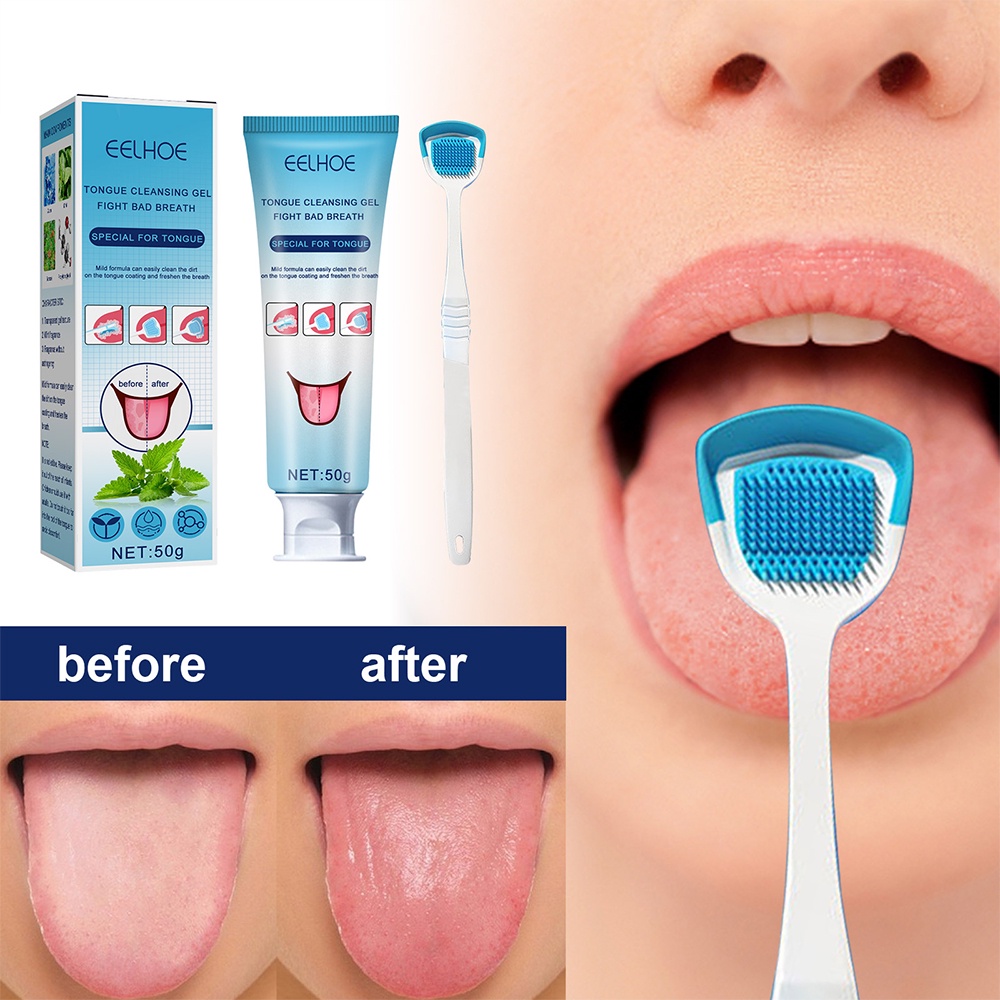 [Romyse] Tongue Cleansing Gel Silicone EELHOE Tongue Scraper Brush Cleaning Single Oral Care