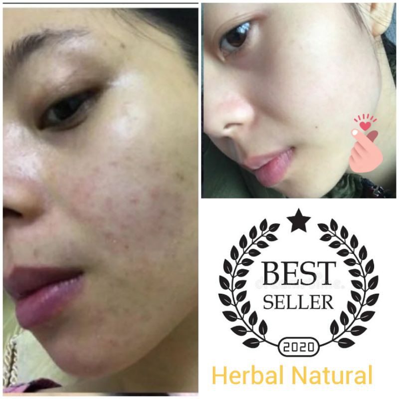 vitamin c mamaearth face cream