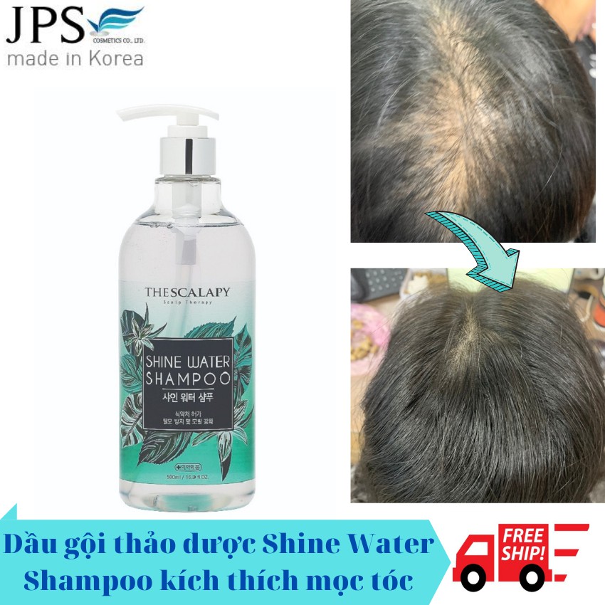 Import] Shine Water herbal shampoo stimulates hair growth, keeps hair  healthy, in the HOT folds in Korea | Shopee Malaysia