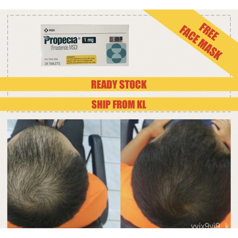 Propeciia Finasterid 1mg | For Hair Loss | Shopee Malaysia