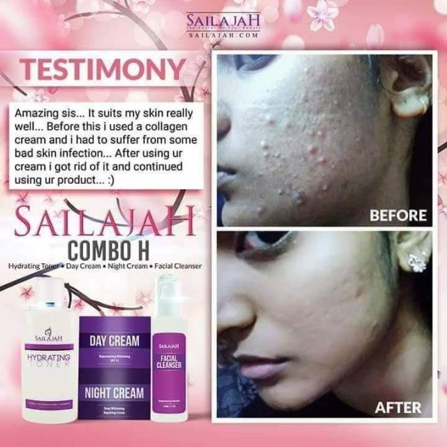 Sailajah Whitening Products 4in1 Shopee Malaysia