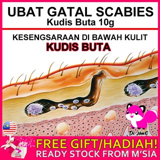 Ubat Gatal Kulit Kudis (Scabies) Allergy Kucing Kutu/Hama Kudis 