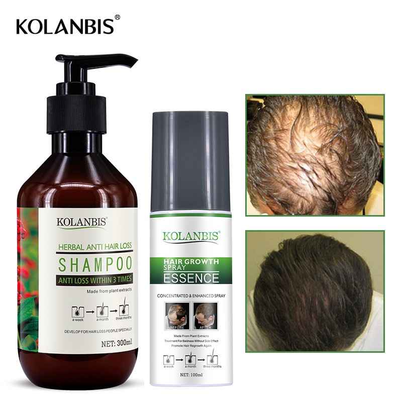 Hair Growth Tonic Essence Spray Shampoo Reduce Hair Fall Thinning