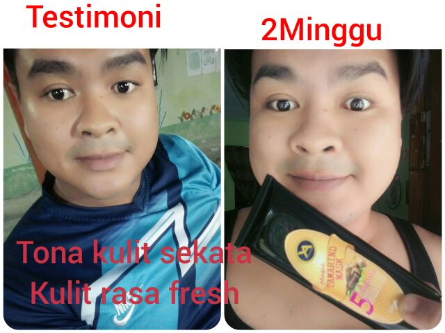 Cream Scar Whitening Magic Tamarind Mask By Yusiqa Beauty Shopee Malaysia