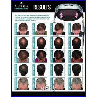 Igrow Hair Growth Laser System Hair Loss Shopee Malaysia