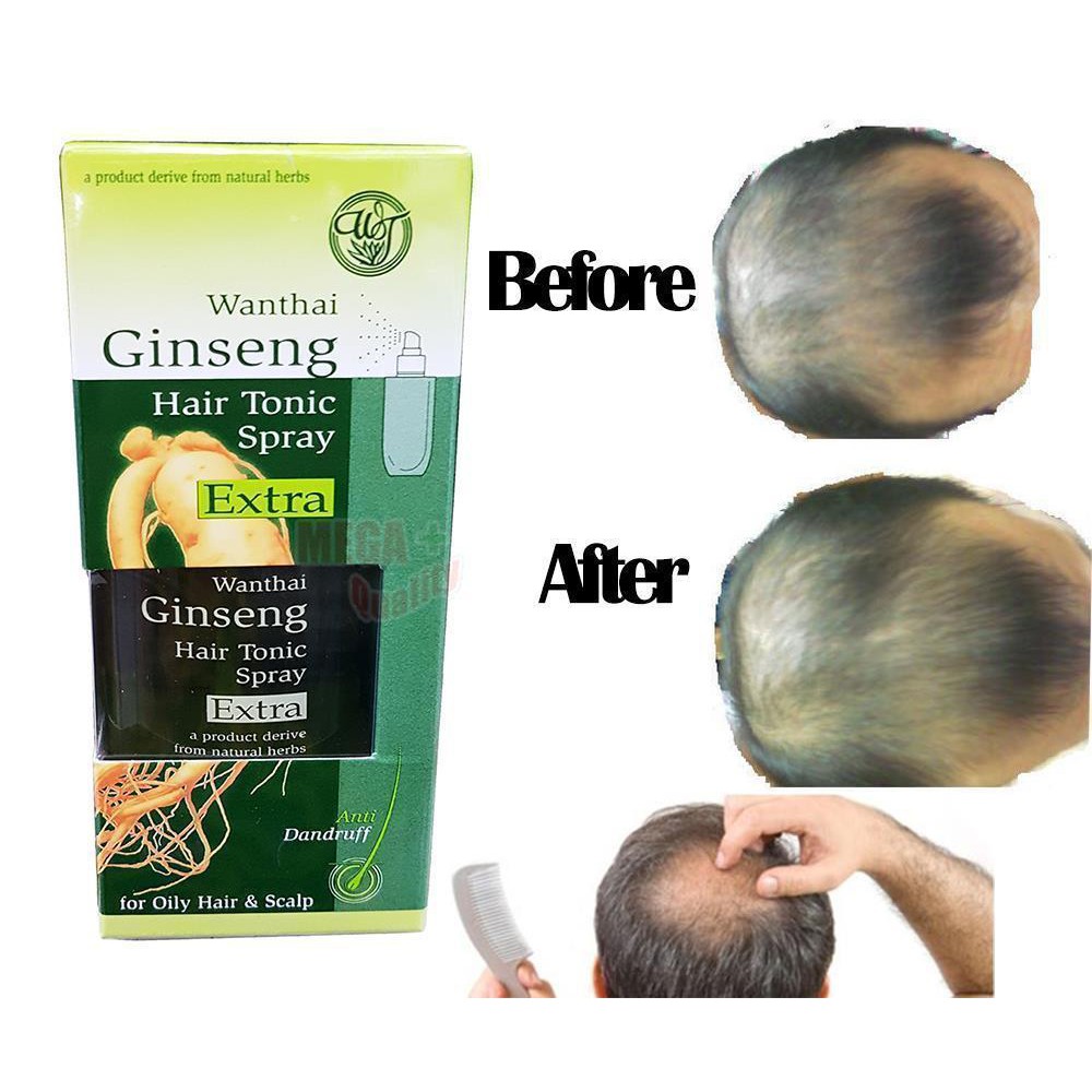 Wanthai Ginseng Hair Tonic Spray Extra For Oily Hair Scalp Anti