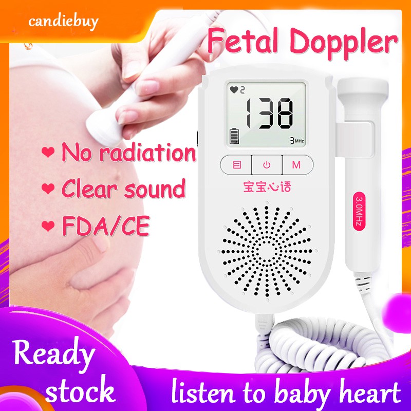 Total 48+ imagen baby heart monitor walmart Viaterra.mx