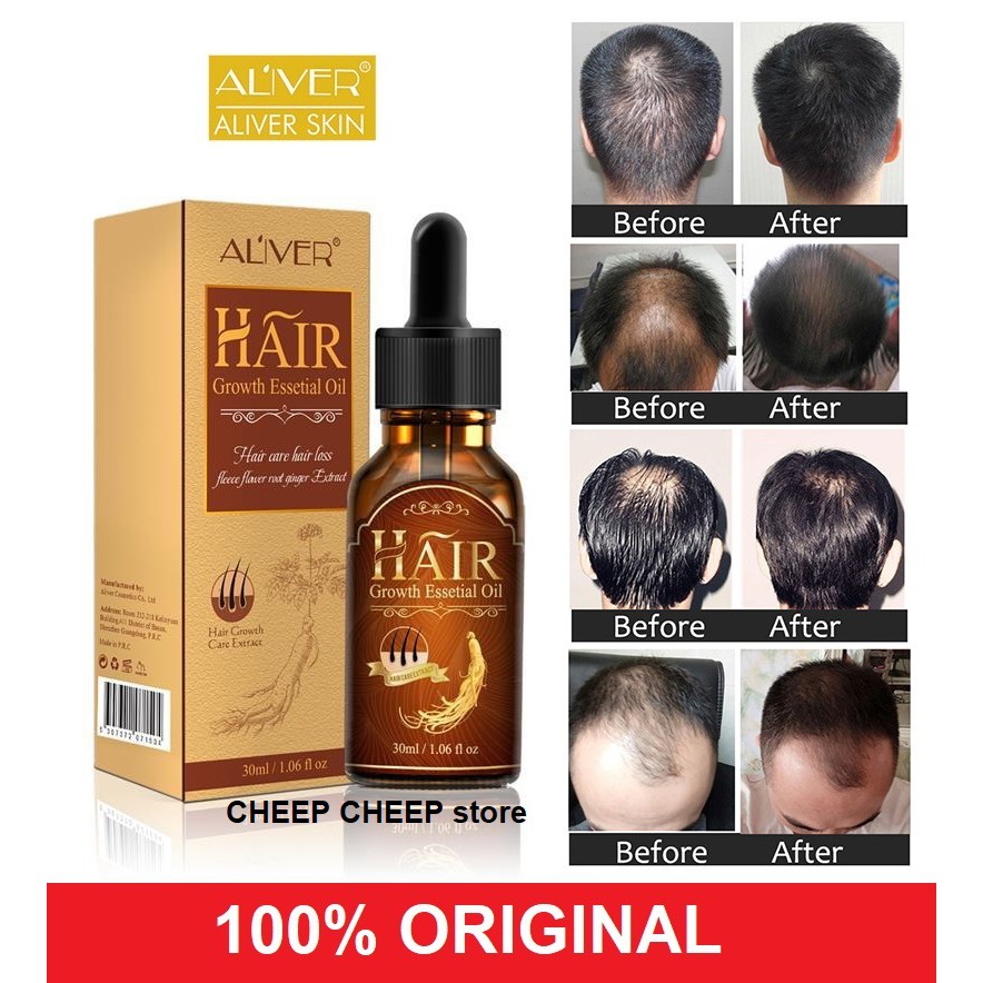 Aliver Hair Growth Essential Oil For Stronger Thicker Hair Reduces