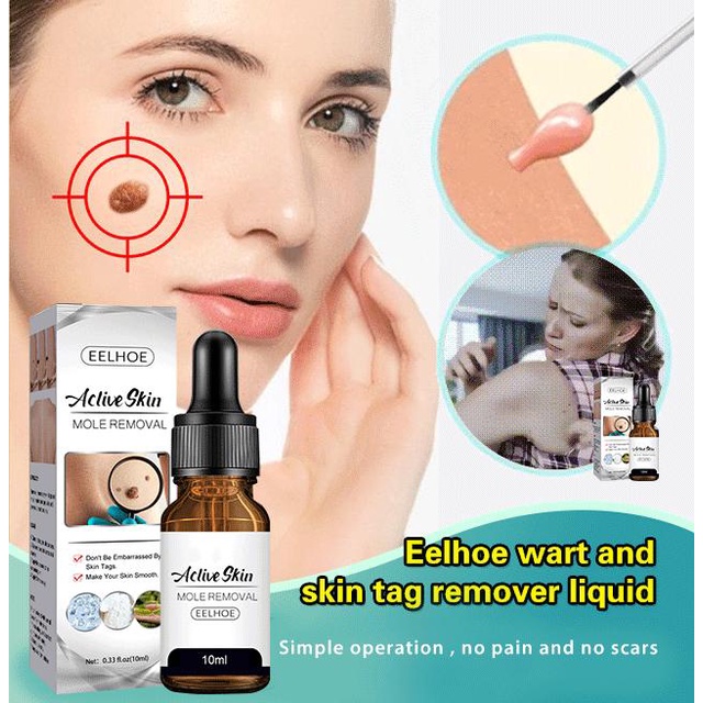 Eelhoe Warts Remover Wart Treatment Skin Tags Aclive Skin Mole Removal