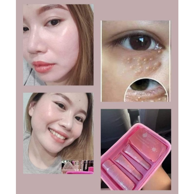 skin luxury by perfect skin Ready stock | Shopee Malaysia