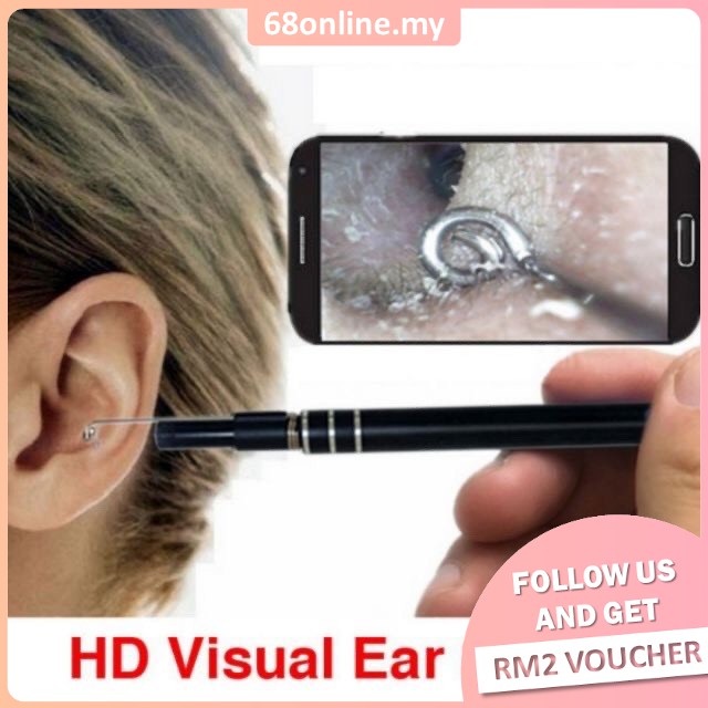 [Johor Seller] S&S Multifunction HD Ear Spoon Cleaning Endoscope Ear Cleaner Removal USB/Android/Type-c With Mini Camera