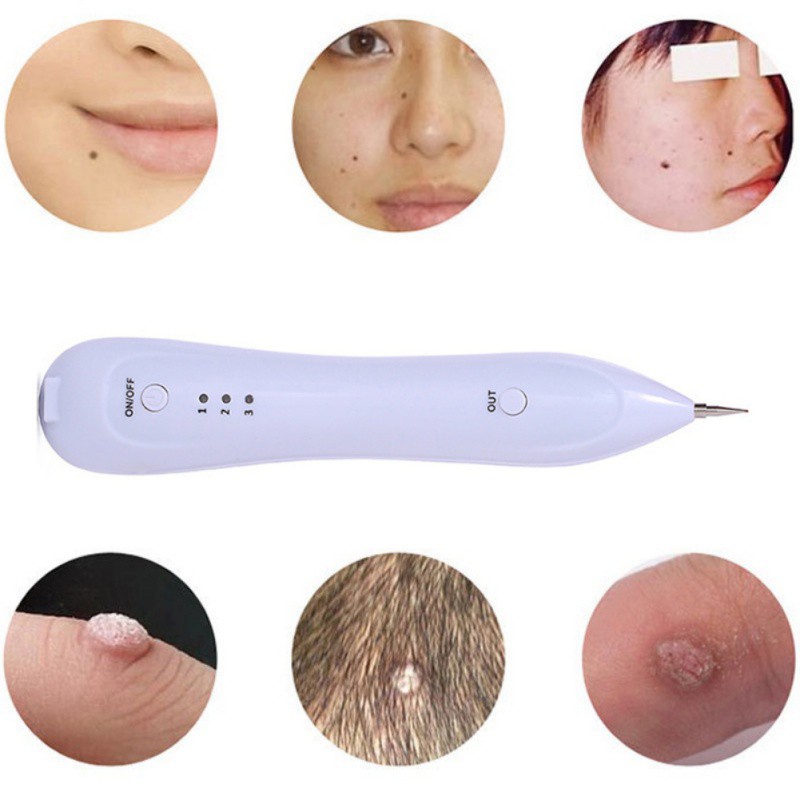 🌹RAYA🌹 Mole Removal Dark Spot Remover Pen Skin Wart Tag ...