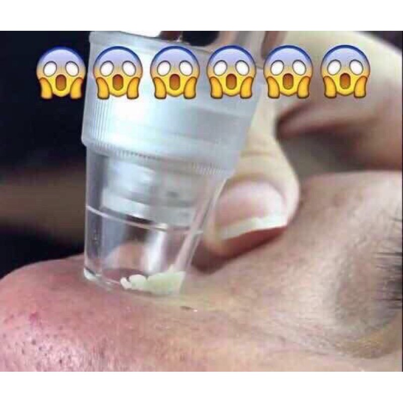 VACUUM BLACKHEAD REMOVER / MESIN PENYEDUT JERAWAT, SEDUT HINGGA KE AKAR, sedut jerawat whitehead kecilkan pori oily .