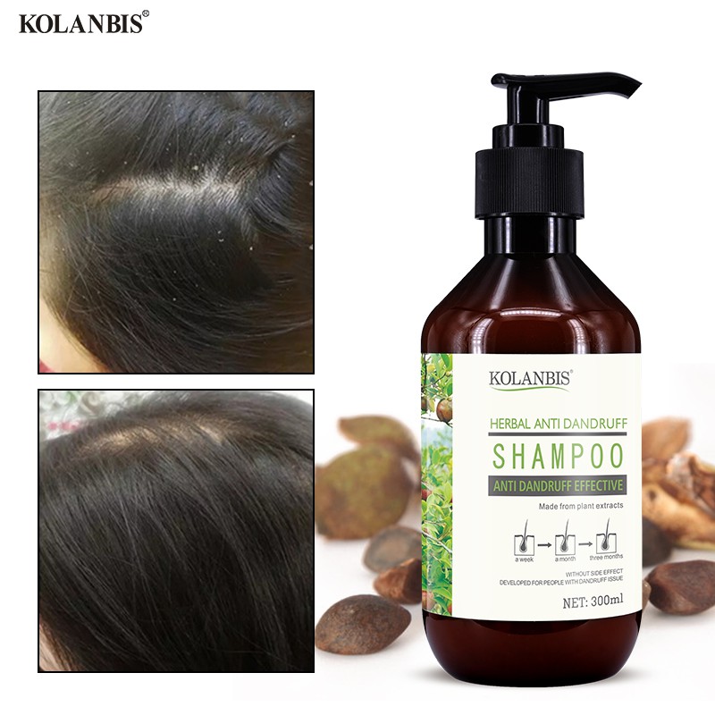 Oily Hair Shampoo Reduce Hair Fall Anti Itch Cure Oily Scalp Hair