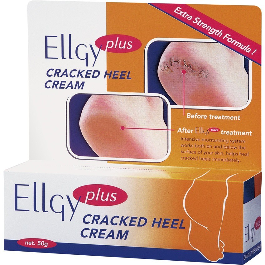 Ellgy Plus Cracked Heel Cream 50g Shopee Malaysia