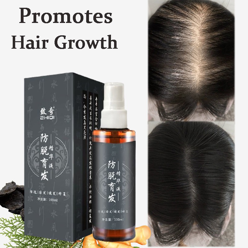 生发精华液-Hair Tonic Serum Fast Hair Growth Serum Hair Tonic For Men &Women Hair  Growth Anti Hair Fall Hair Loss Serum 100ml | Shopee Malaysia