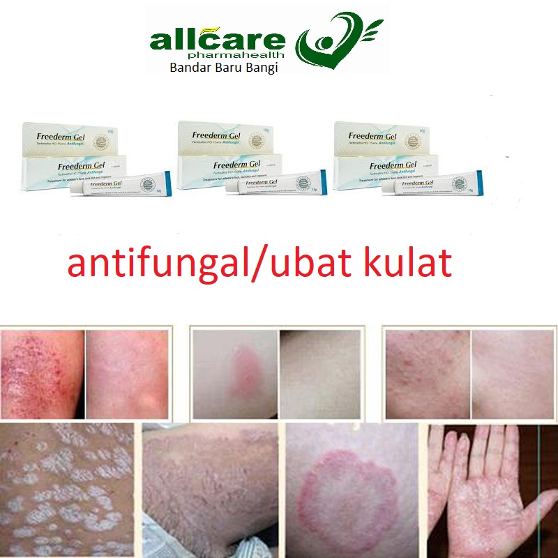 Freederm Antifungal / ubat kulat Gel 10g | Shopee Malaysia