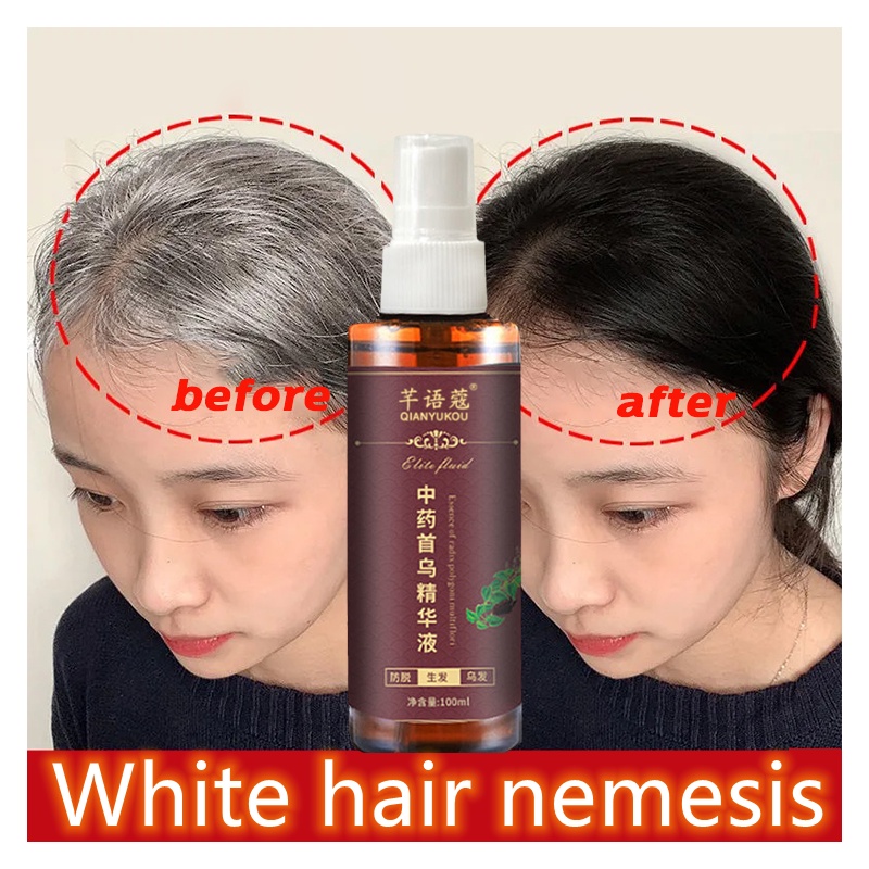 Black Hair Spray Black Hair Shampoo White Hair Turn Black Hair Care
