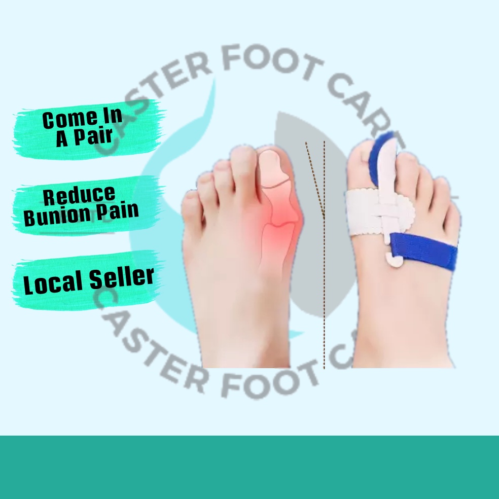 Bunion Corrector & Bunion Relief Orthopedic Protector Sleeves Pad Kit