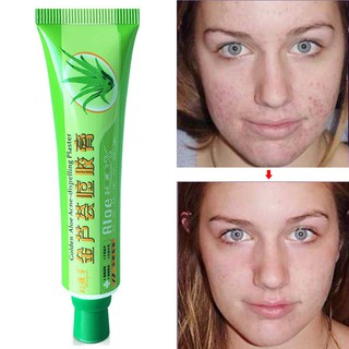 Acne Dispelling Plaster removal cream Aloe Vera Gel | Shopee Malaysia