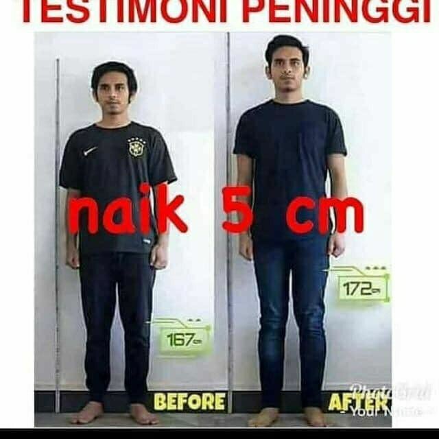 Peninggi Badan Super Grow Up Ubat Tinggi Badan Paling Berkesan Malaysia 1 3 Cm Original Shopee Malaysia