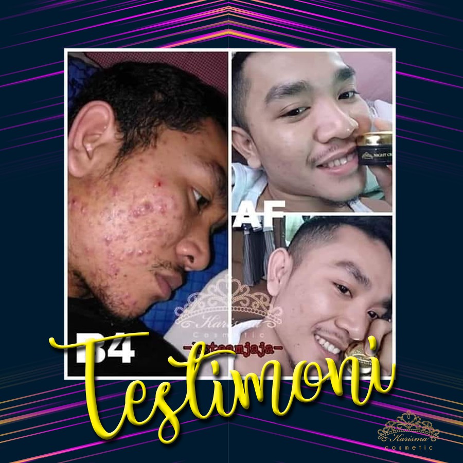 testimoni karisma skincare