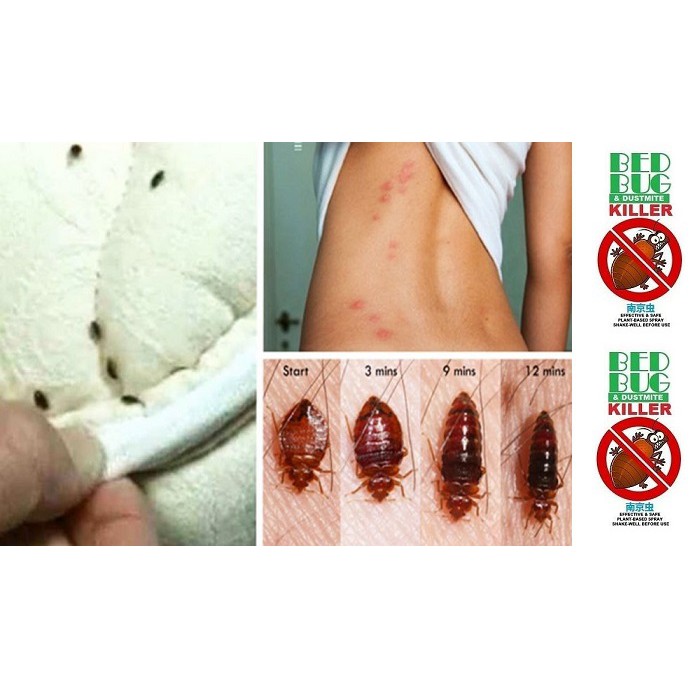 Bedbugs Dustmite Killer Spray Hot Item Basmi Pijat Racun Pijat Ubat Pijat Kutu Hama Anti Bac Shopee Malaysia