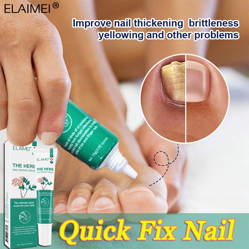 Nail Repair Cream Nail fungus cream Nail Soothing Repair Cream bright  antifungal nail Onychomycocosis repair Treatment | Shopee Malaysia