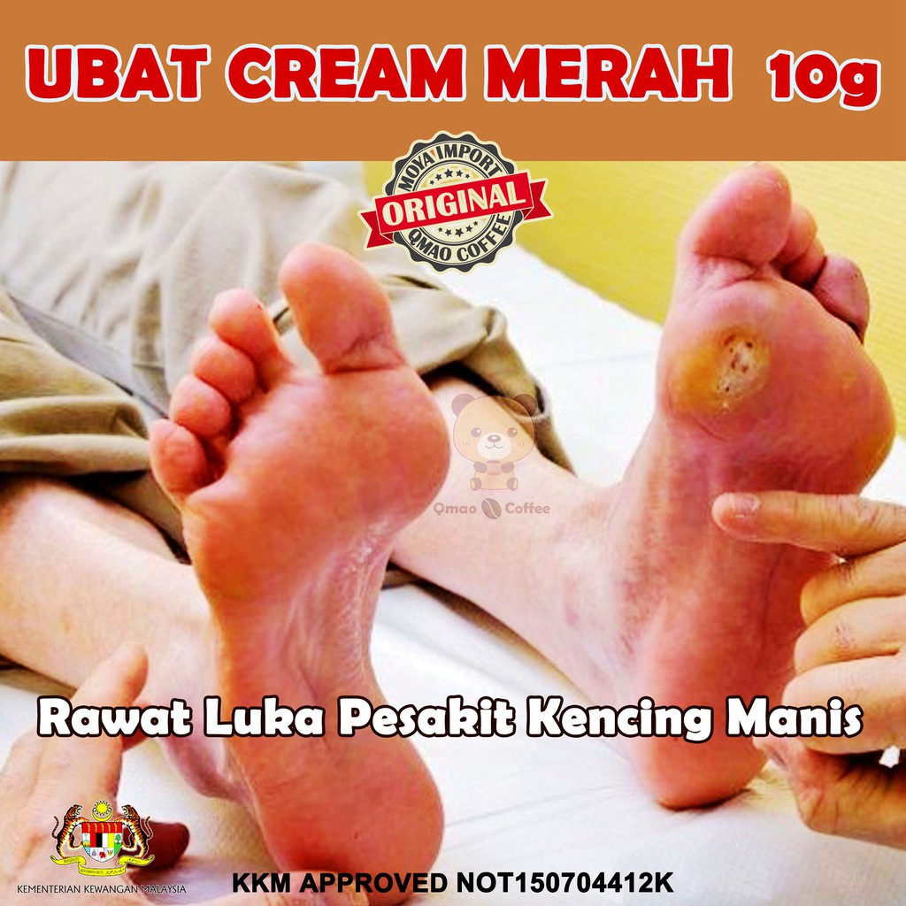 Ubat Luka Kaki Diabetes,Kayap,Kencing Manis,Bakar Allergy Ekzema