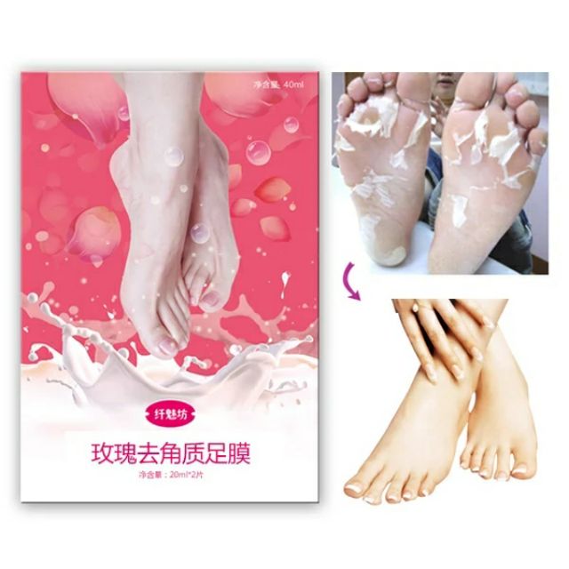 Hot Foot Mask 嫩脚脱皮去死皮老茧去角质脚底脚后跟干裂足部护理脚膜 Shopee Malaysia