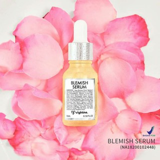 VIGHTNE BLEMISH SERUM BY VAVL (VIVALENTINE) FREE GIFT  