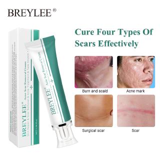 Breylee Acne Scar Removal Cream 30g Face Cream Skin Repair Skin Care Scar Acne Treatment Remove Stretch Marks Whitening Cream 1pcs