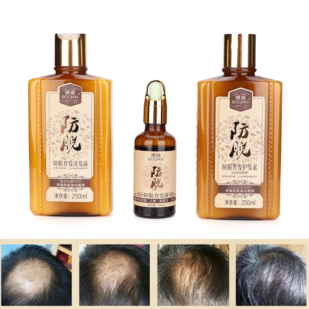 Bakelili 3 In 1 Shampoo Conditioner Hair Regrowth Oil Anti Hair